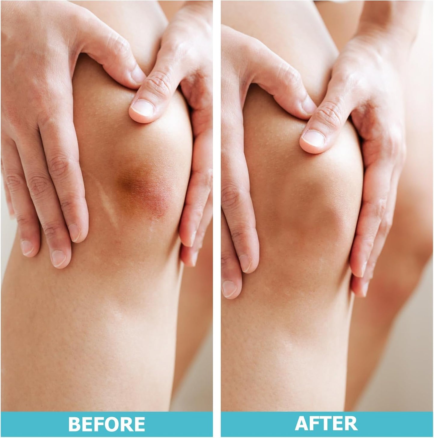 Hydrocolloid Wound Care Roll (WHC210RT) - HSA FSA Eligible 2 inches x 10 feet, 19.7 mil thickness, cut to size, extra large hydrocolloid patch bandages with