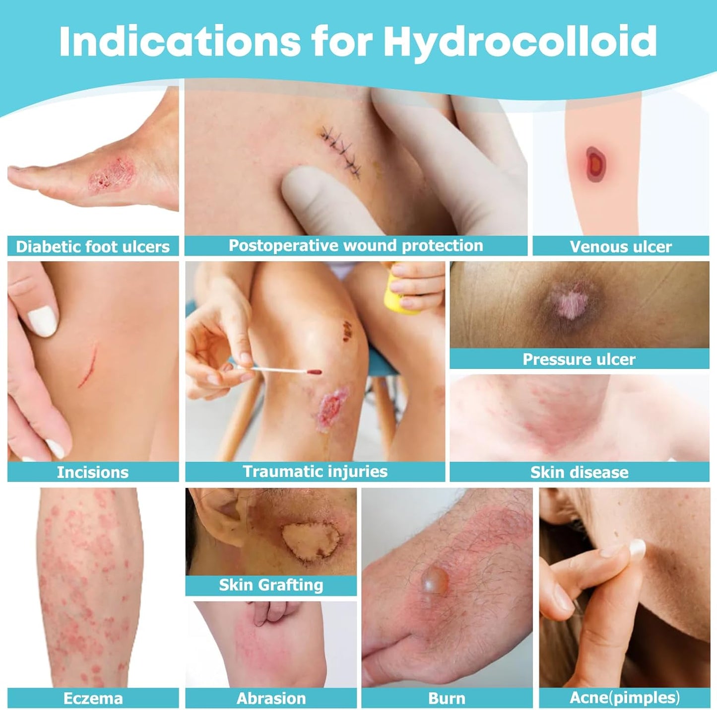 Hydrocolloid Wound Care Roll (WHC210RT) - HSA FSA Eligible 2 inches x 10 feet, 19.7 mil thickness, cut to size, extra large hydrocolloid patch bandages with