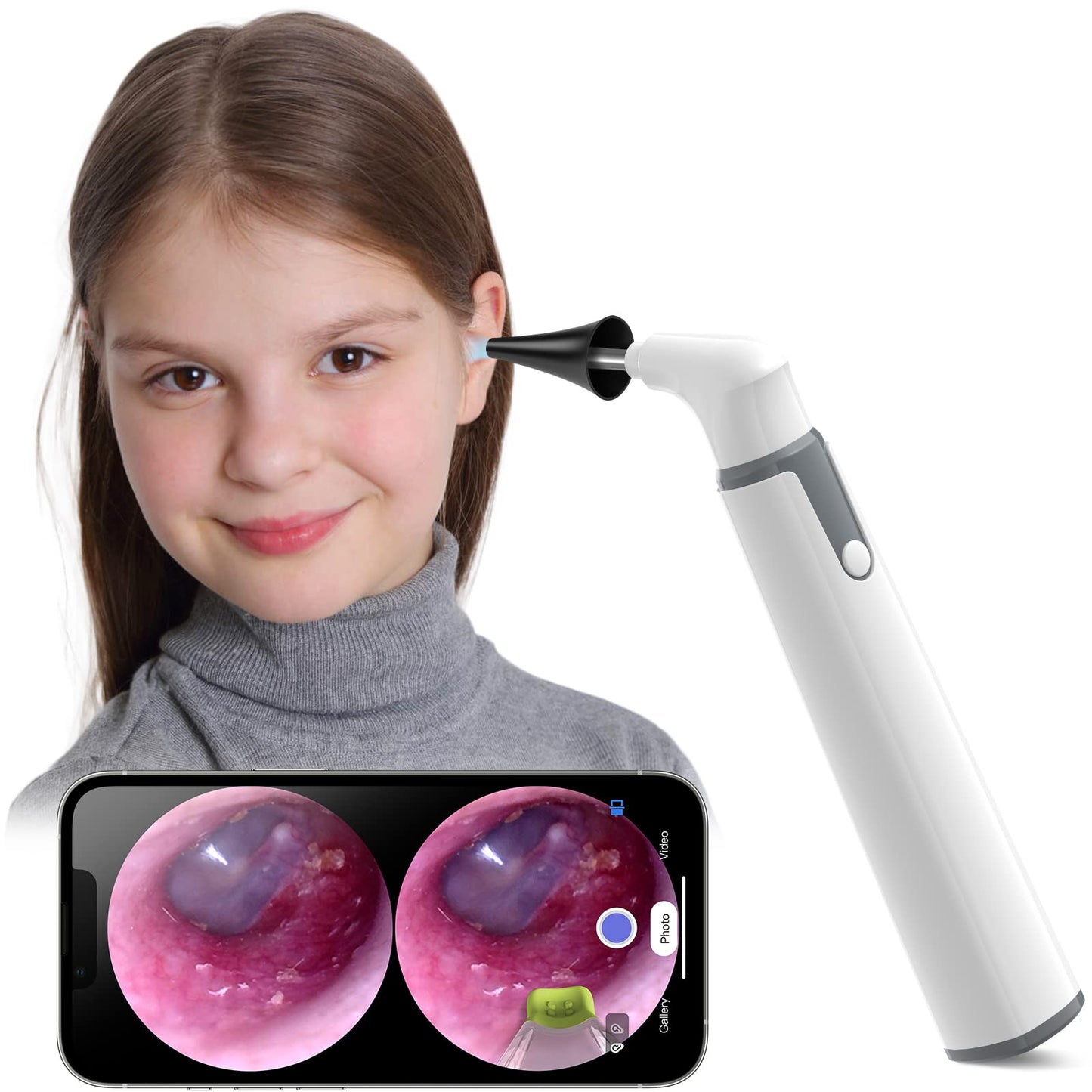 ScopeAround Otoscope with Light, Otoscope Camera w/Dual View, 720pHD WiFi Ear Scope w/ 6 LED Lights, Ear Camera 3.9mm Lens for Kids & Adults, Ear Scope Compatible w/Android & iPhone