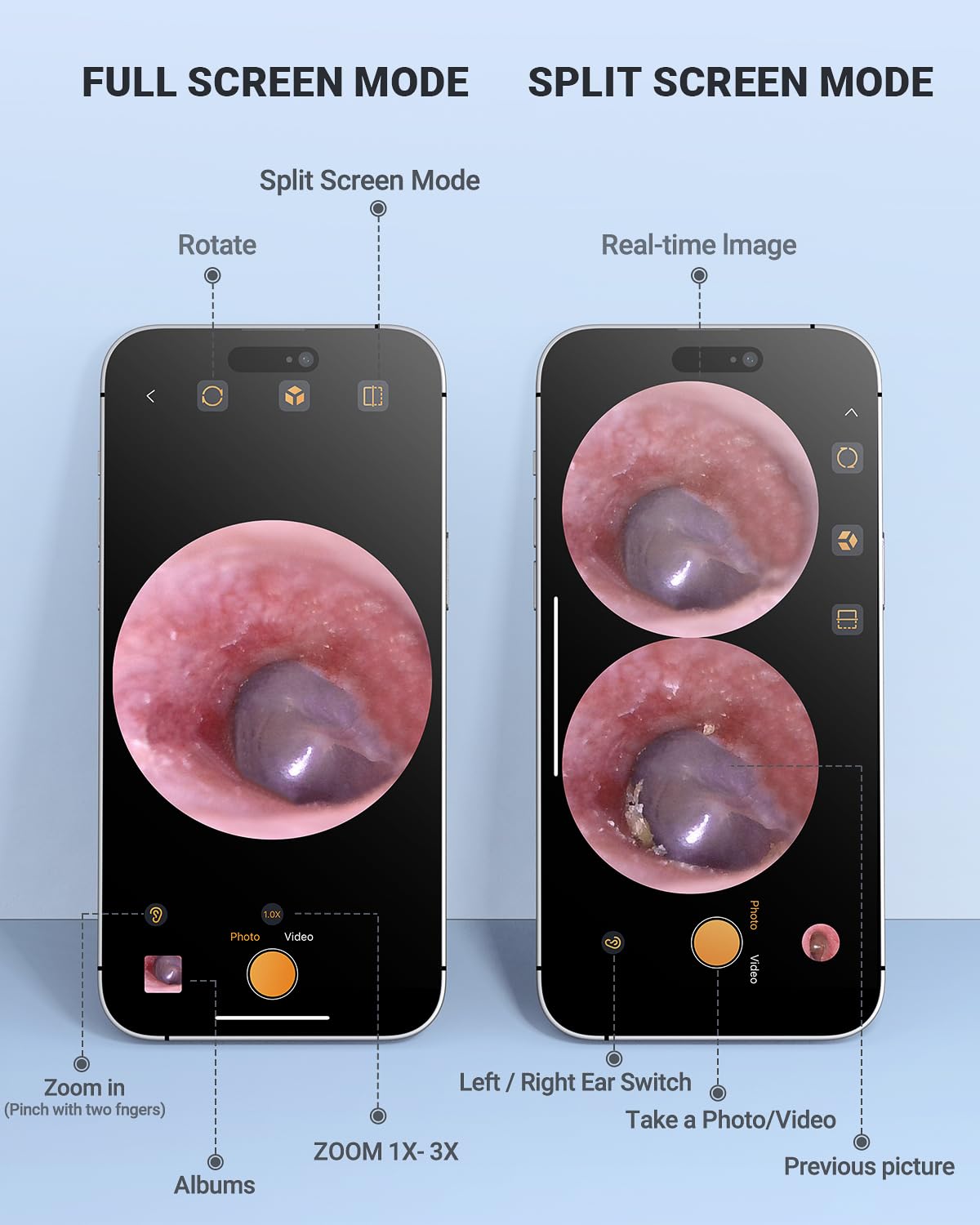 Digital Otoscope Compatible with iPhone and Android Devices, HD Ear Camera with Ear Wax Removal Tools, Video Ear Scope Otoscope with Light, Capture Photos and Videos (Silver)