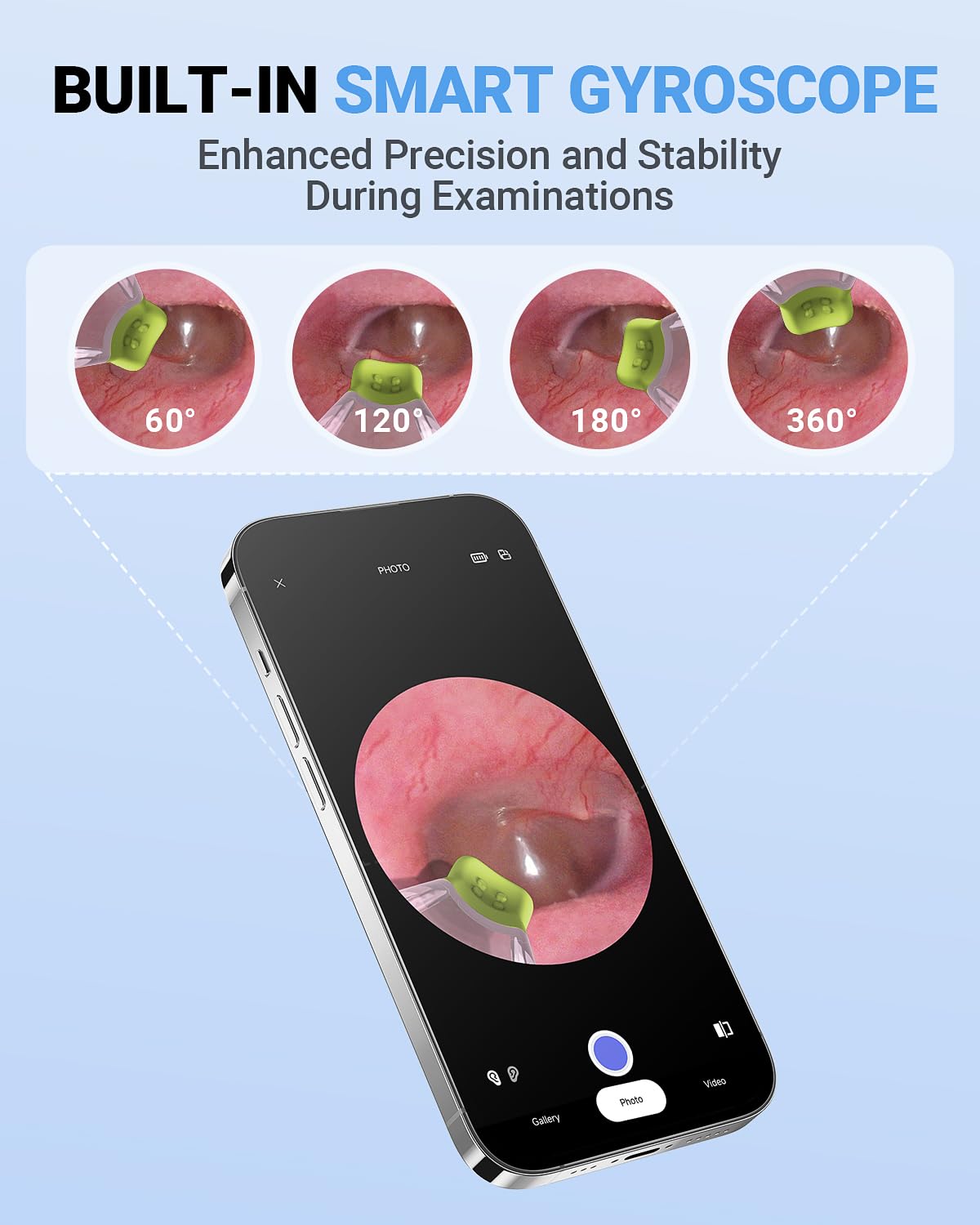 ScopeAround Otoscope with Light, Otoscope Camera w/Dual View, 720pHD WiFi Ear Scope w/ 6 LED Lights, Ear Camera 3.9mm Lens for Kids & Adults, Ear Scope Compatible w/Android & iPhone