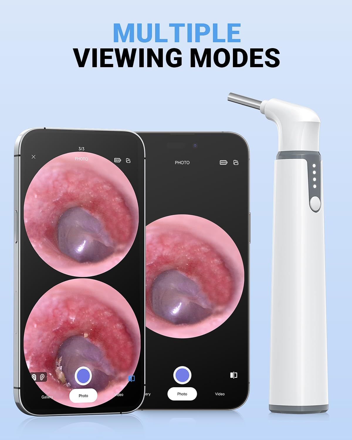 ScopeAround Otoscope with Light, Otoscope Camera w/Dual View, 720pHD WiFi Ear Scope w/ 6 LED Lights, Ear Camera 3.9mm Lens for Kids & Adults, Ear Scope Compatible w/Android & iPhone